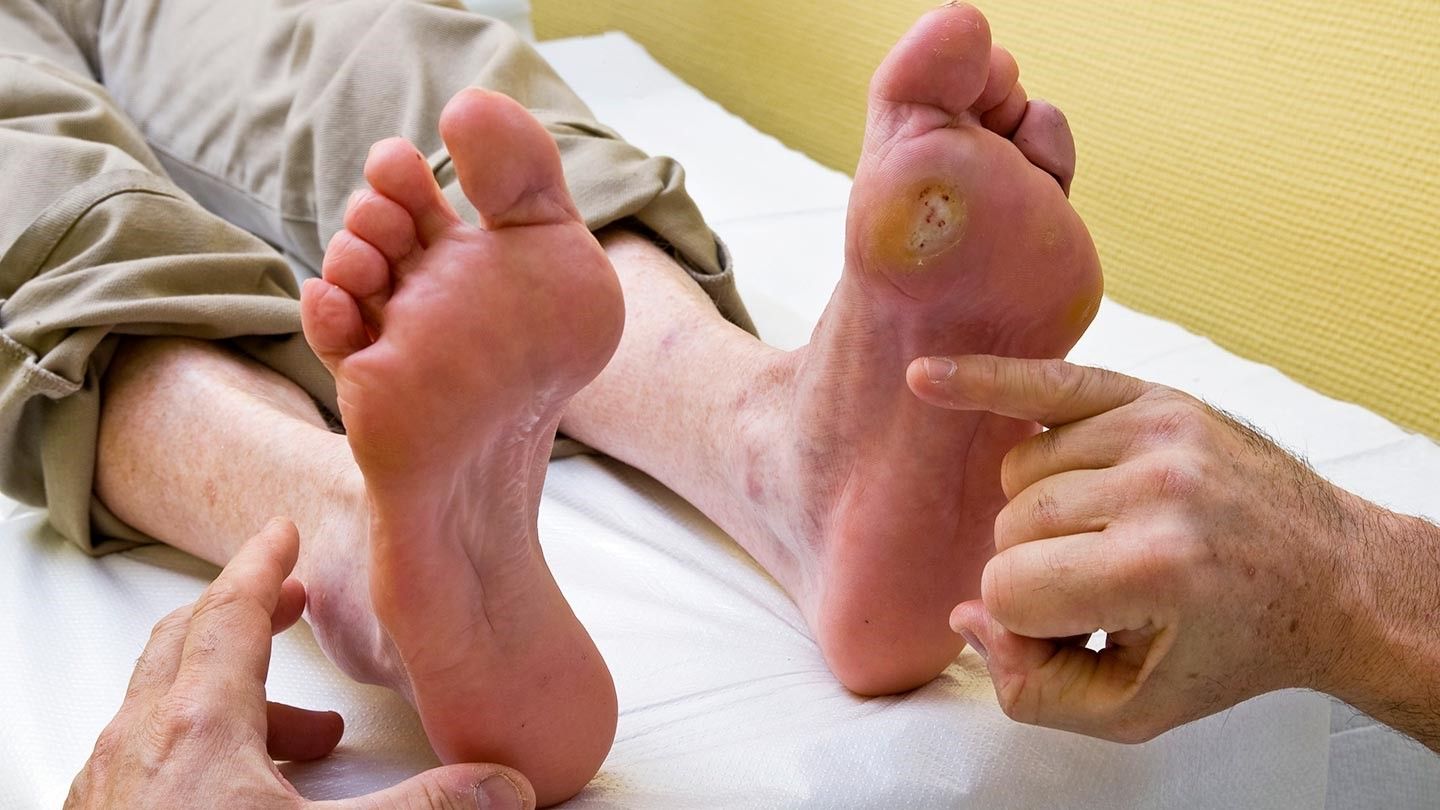 cancerblogimage1